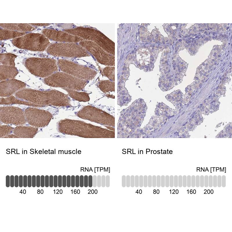 Sarcalumenin Antibody - BSA Free Immunohistochemistry: Sarcalumenin Antibody - BSA Free [NBP2-13379]