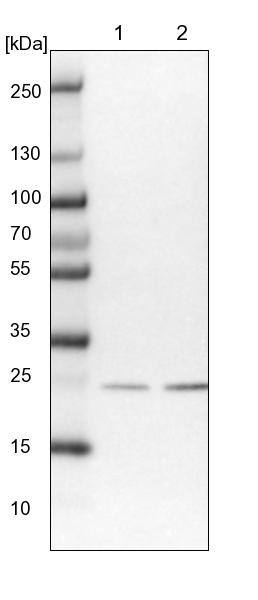 SSSCA1 Antibody - BSA Free Western Blot: SSSCA1 Antibody - BSA Free [NBP2-13387]