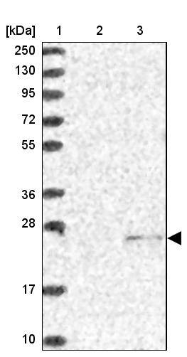 SSSCA1 Antibody - BSA Free Western Blot: SSSCA1 Antibody - BSA Free [NBP2-13387]