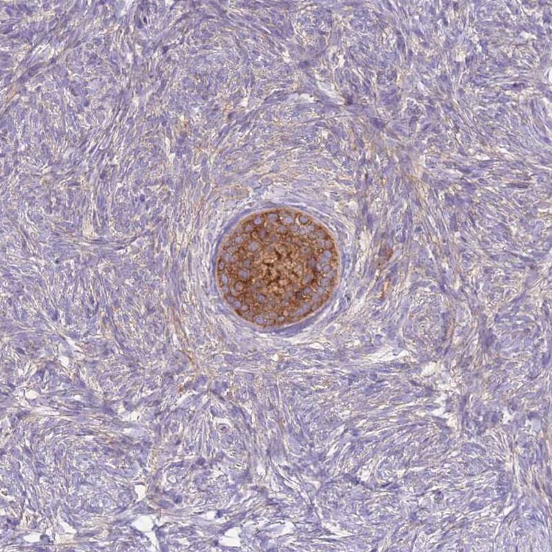 ST3GAL4 Antibody - BSA Free Immunohistochemistry: ST3GAL4 Antibody - BSA Free [NBP2-13390]
