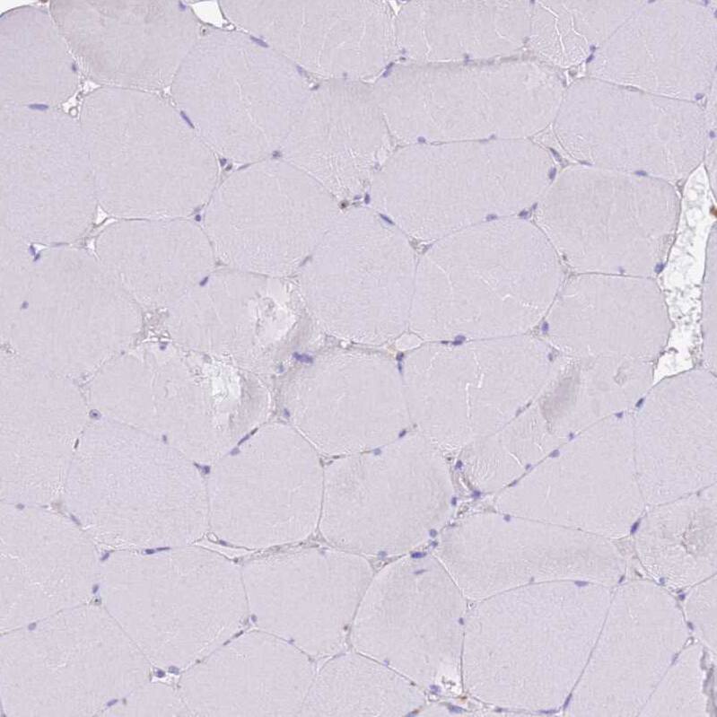 ST3GAL4 Antibody - BSA Free Immunohistochemistry: ST3GAL4 Antibody - BSA Free [NBP2-13390]