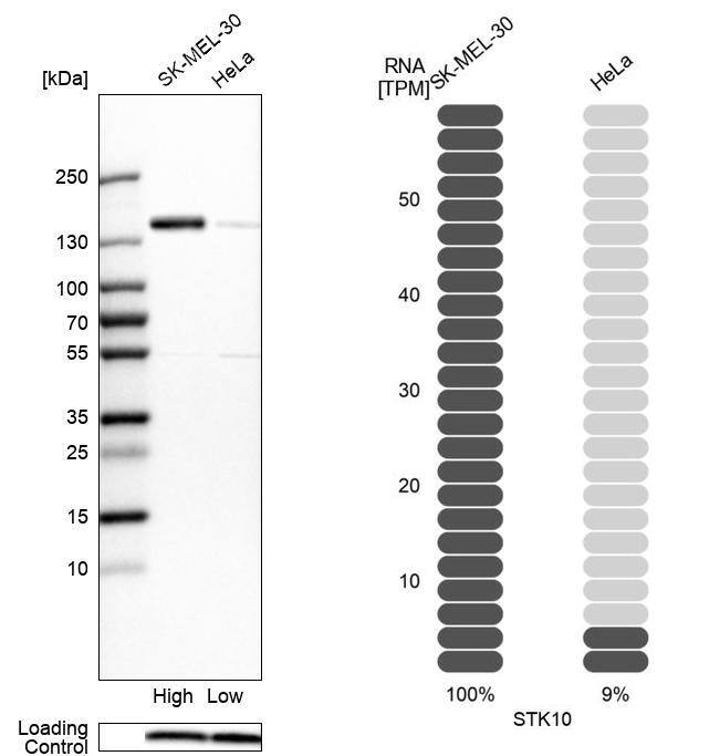 LOK Antibody - BSA Free Western Blot: LOK Antibody - BSA Free [NBP2-13396]
