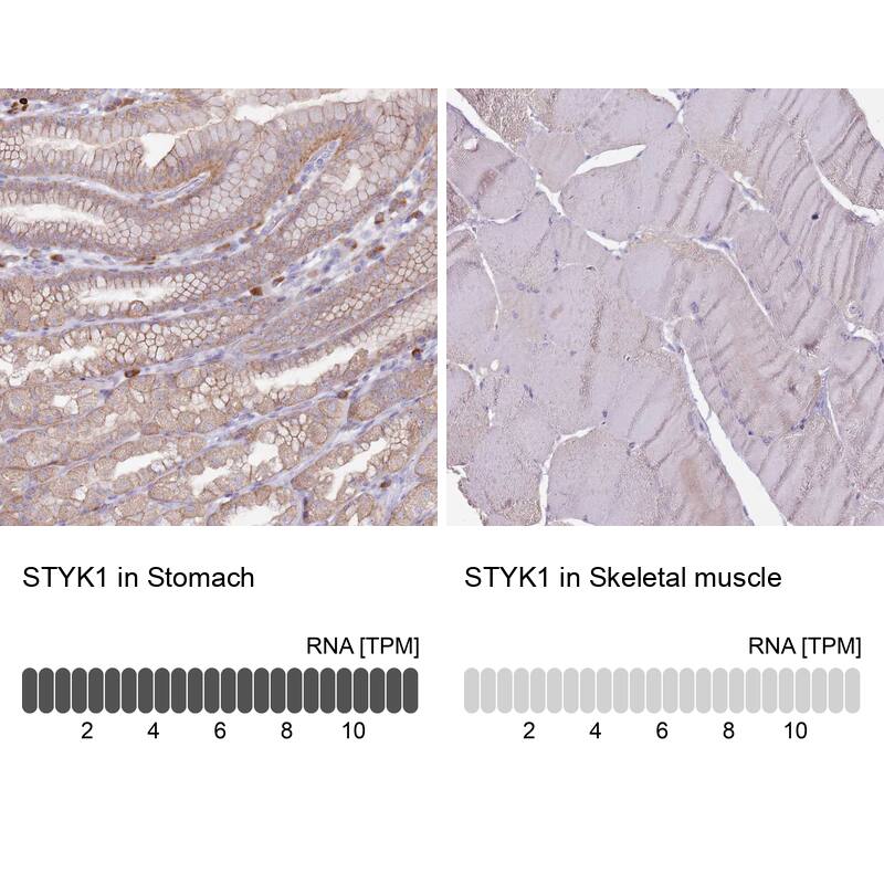 STYK1 Antibody - BSA Free Immunohistochemistry: STYK1 Antibody - BSA Free [NBP2-13398]