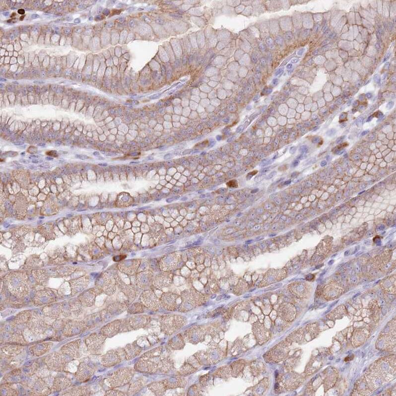 STYK1 Antibody - BSA Free Immunohistochemistry: STYK1 Antibody - BSA Free [NBP2-13398]