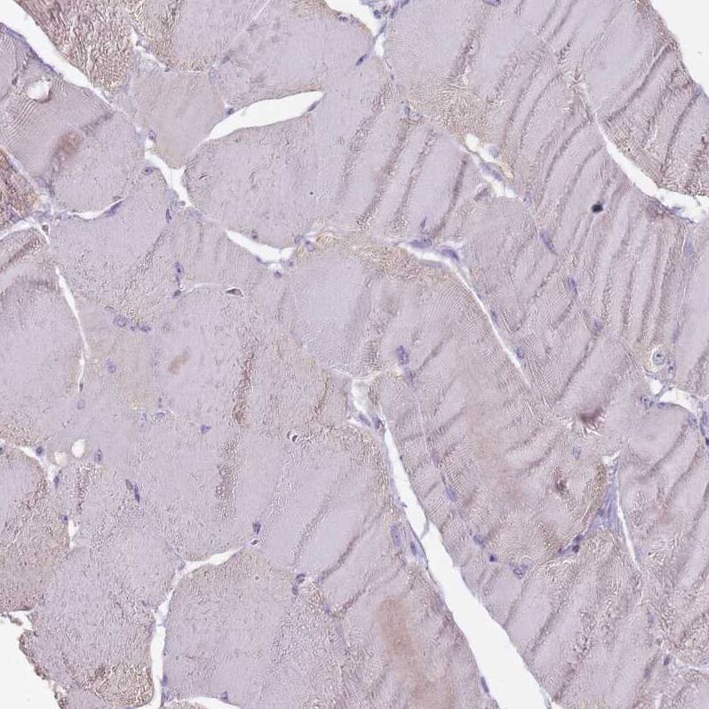 STYK1 Antibody - BSA Free Immunohistochemistry: STYK1 Antibody - BSA Free [NBP2-13398]
