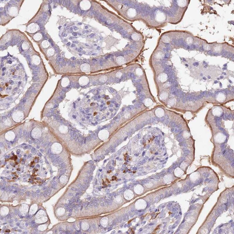 STYK1 Antibody - BSA Free Immunohistochemistry: STYK1 Antibody - BSA Free [NBP2-13398]