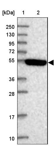 STYK1 Antibody - BSA Free Western Blot: STYK1 Antibody - BSA Free [NBP2-13398]