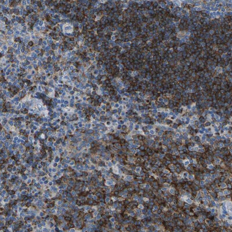 Synaptogyrin 2 Antibody - BSA Free Immunohistochemistry: Synaptogyrin 2 Antibody - BSA Free [NBP2-13403]
