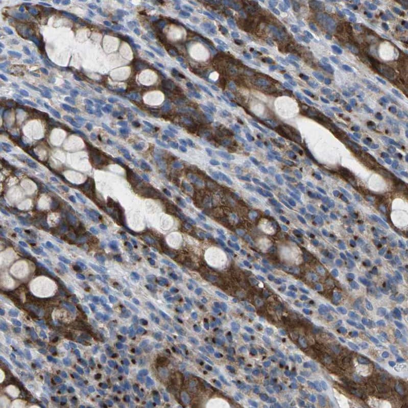 Synaptogyrin 2 Antibody - BSA Free Immunohistochemistry: Synaptogyrin 2 Antibody - BSA Free [NBP2-13403]