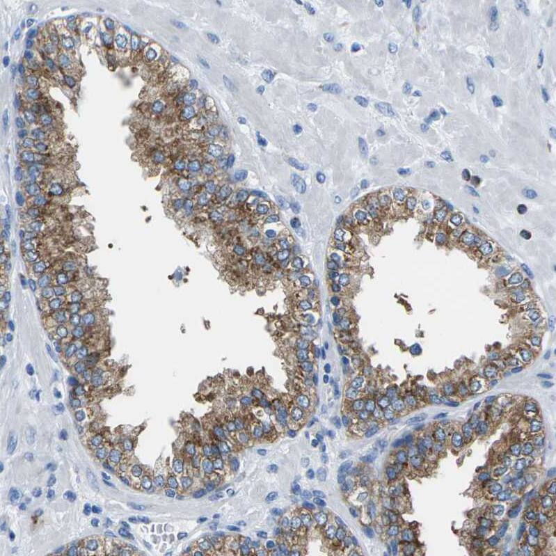 Synaptogyrin 2 Antibody - BSA Free Immunohistochemistry: Synaptogyrin 2 Antibody - BSA Free [NBP2-13403]