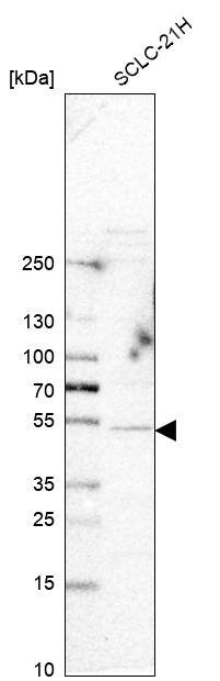 Synaptotagmin 4 Antibody - BSA Free Western Blot: Synaptotagmin 4 Antibody - BSA Free [NBP2-13408]