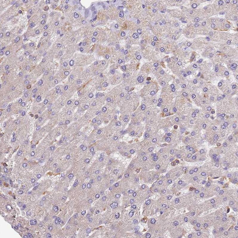 Synaptotagmin 4 Antibody - BSA Free Immunohistochemistry: Synaptotagmin 4 Antibody - BSA Free [NBP2-13408]