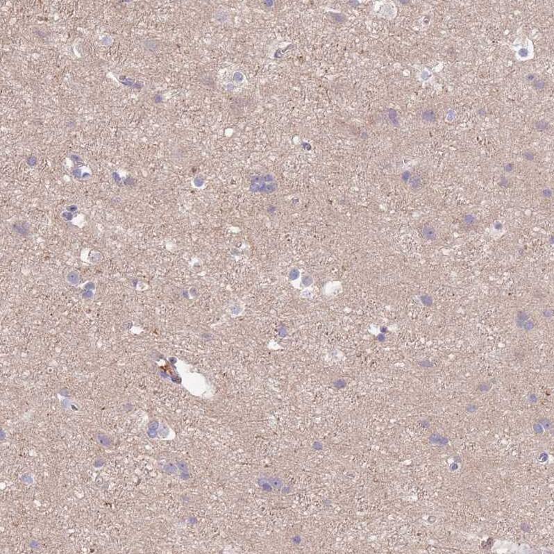 Synaptotagmin 4 Antibody - BSA Free Immunohistochemistry: Synaptotagmin 4 Antibody - BSA Free [NBP2-13408]