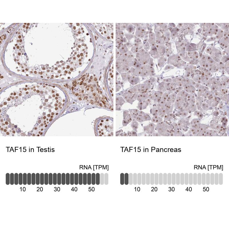 TAF15 Antibody - BSA Free Immunohistochemistry: TAF15 Antibody - BSA Free [NBP2-13410]