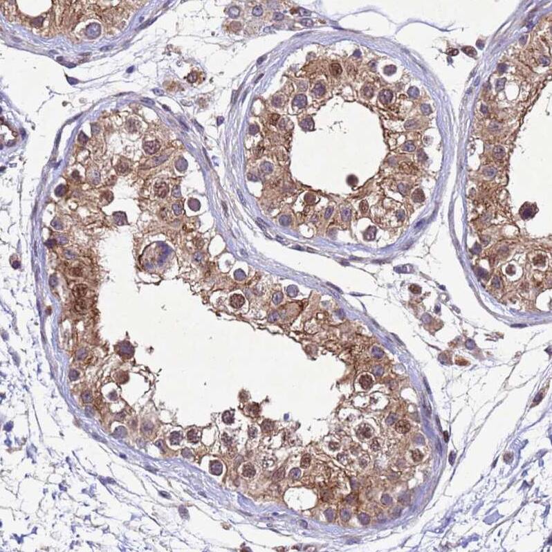 TBK1 Antibody - BSA Free Immunohistochemistry: TBK1 Antibody - BSA Free [NBP2-13416]