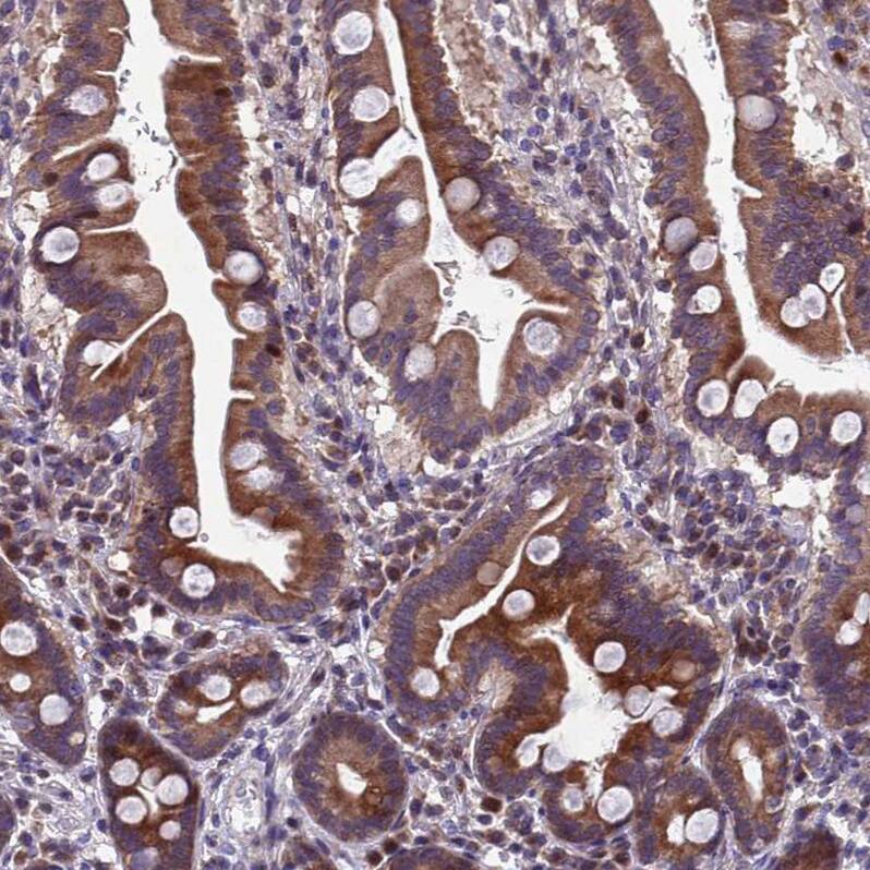 TBK1 Antibody - BSA Free Immunohistochemistry: TBK1 Antibody - BSA Free [NBP2-13416]