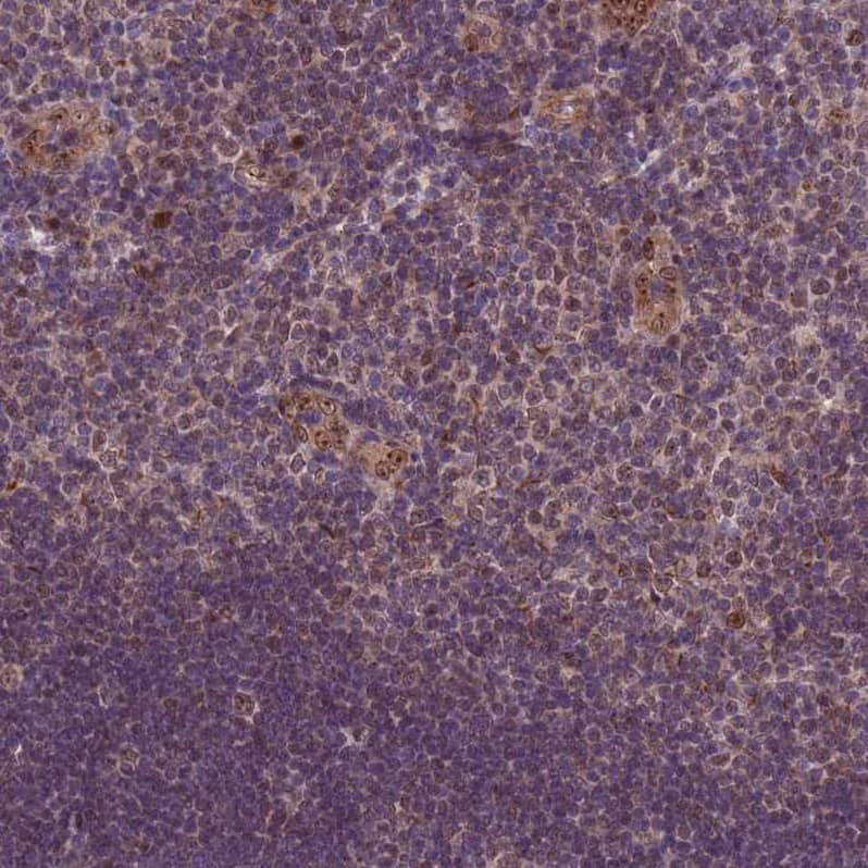 TBK1 Antibody - BSA Free Immunohistochemistry: TBK1 Antibody - BSA Free [NBP2-13416]