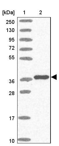 TBX10 Antibody - BSA Free Western Blot: TBX10 Antibody - BSA Free [NBP2-13417]