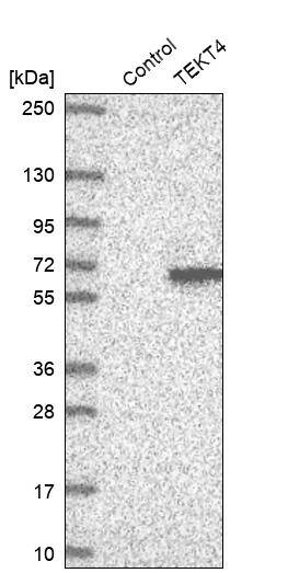 TEKT4 Antibody - BSA Free Western Blot: TEKT4 Antibody - BSA Free [NBP2-13425]