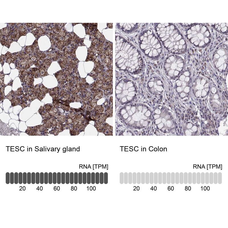 tescalcin Antibody - BSA Free Immunohistochemistry: tescalcin Antibody - BSA Free [NBP2-13426]