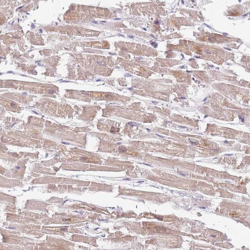 TIMM13 Antibody - BSA Free Immunohistochemistry: TIMM13 Antibody - BSA Free [NBP2-13431]