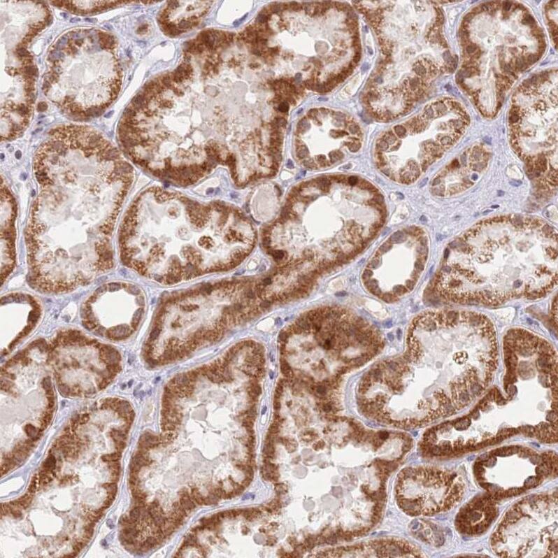 TIMM13 Antibody - BSA Free Immunohistochemistry: TIMM13 Antibody - BSA Free [NBP2-13431]