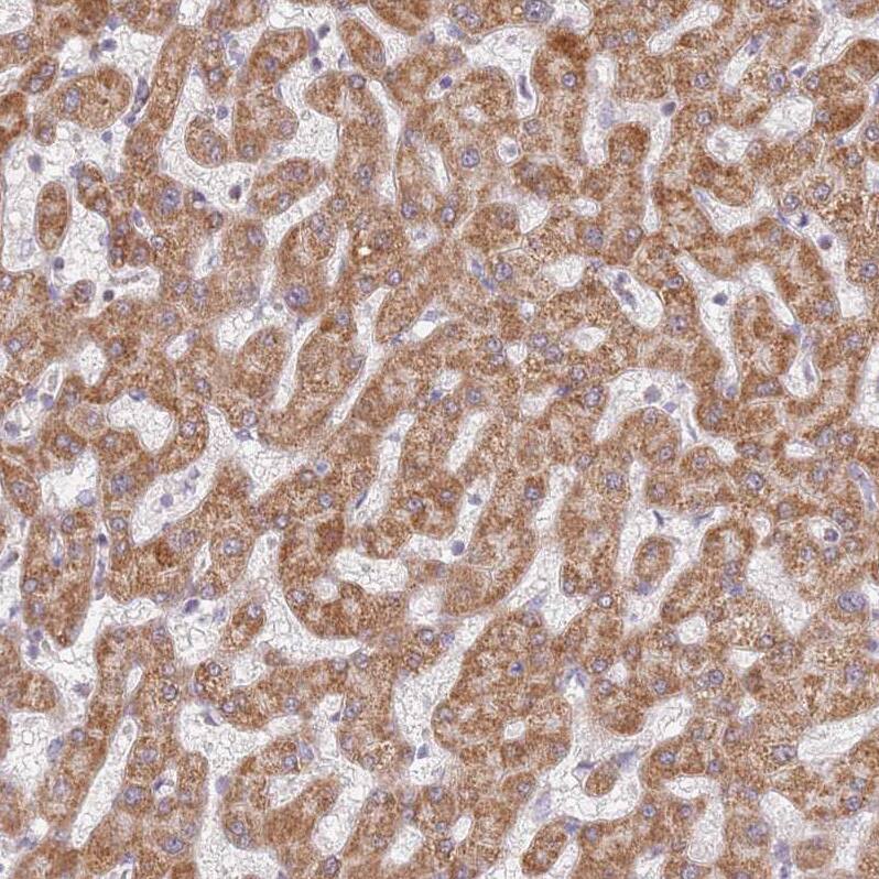 TIMM13 Antibody - BSA Free Immunohistochemistry: TIMM13 Antibody - BSA Free [NBP2-13431]