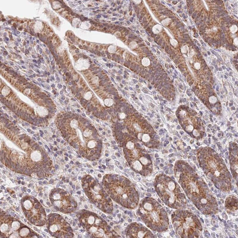 TIMM13 Antibody - BSA Free Immunohistochemistry: TIMM13 Antibody - BSA Free [NBP2-13431]