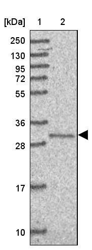 TIMMDC1 Antibody - BSA Free Western Blot: TIMMDC1 Antibody - BSA Free [NBP2-13433]