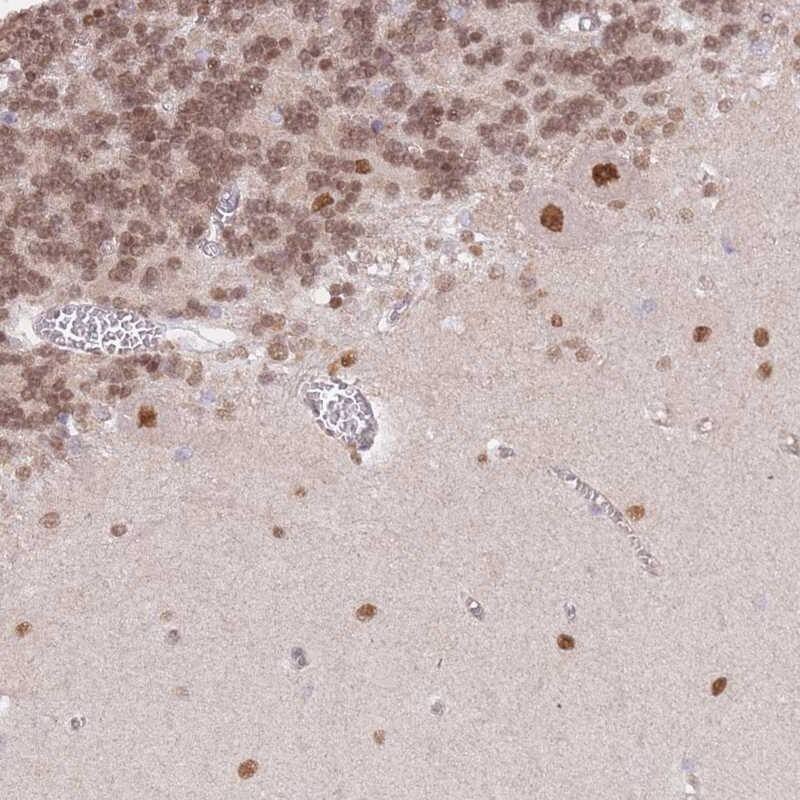 TLE2 Antibody - BSA Free Immunohistochemistry: TLE2 Antibody - BSA Free [NBP2-13435]