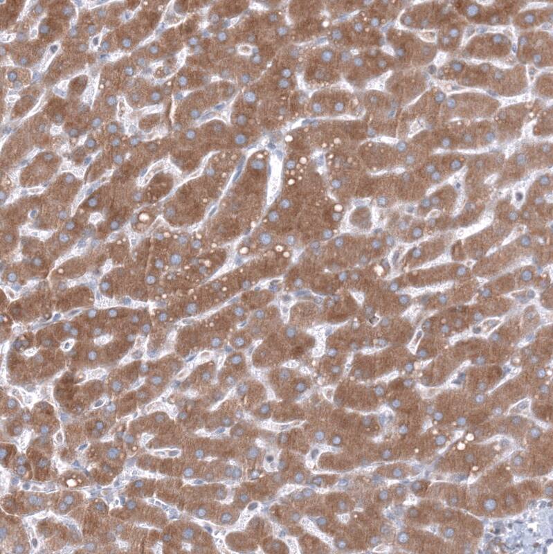 TMED5 Antibody - BSA Free Immunohistochemistry: TMED5 Antibody - BSA Free [NBP2-13440]