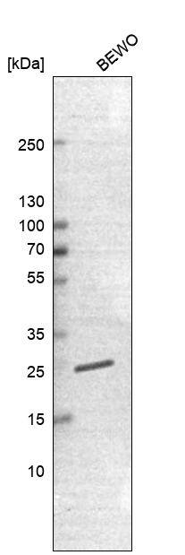 TMED5 Antibody - BSA Free Western Blot: TMED5 Antibody - BSA Free [NBP2-13440]