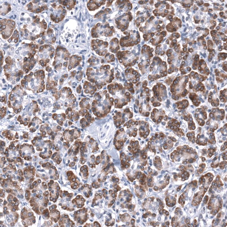 TMED5 Antibody - BSA Free Immunohistochemistry: TMED5 Antibody - BSA Free [NBP2-13440]