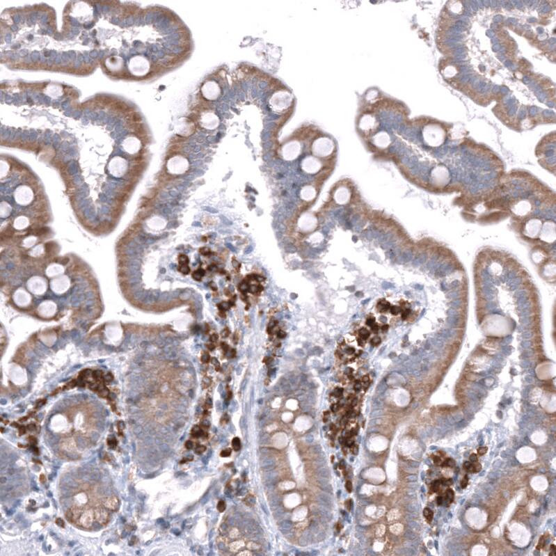 TMED5 Antibody - BSA Free Immunohistochemistry: TMED5 Antibody - BSA Free [NBP2-13440]