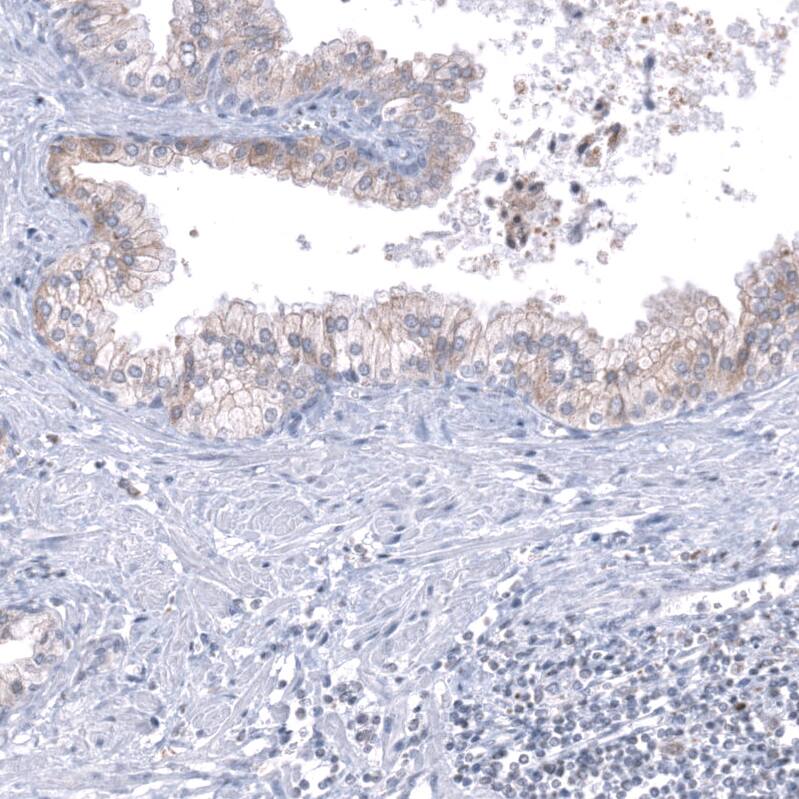 TMED5 Antibody - BSA Free Immunohistochemistry: TMED5 Antibody - BSA Free [NBP2-13440]