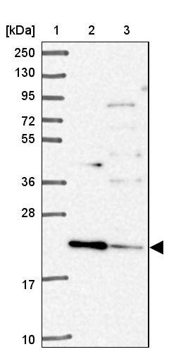 TMEM11 Antibody - BSA Free Western Blot: TMEM11 Antibody - BSA Free [NBP2-13443]
