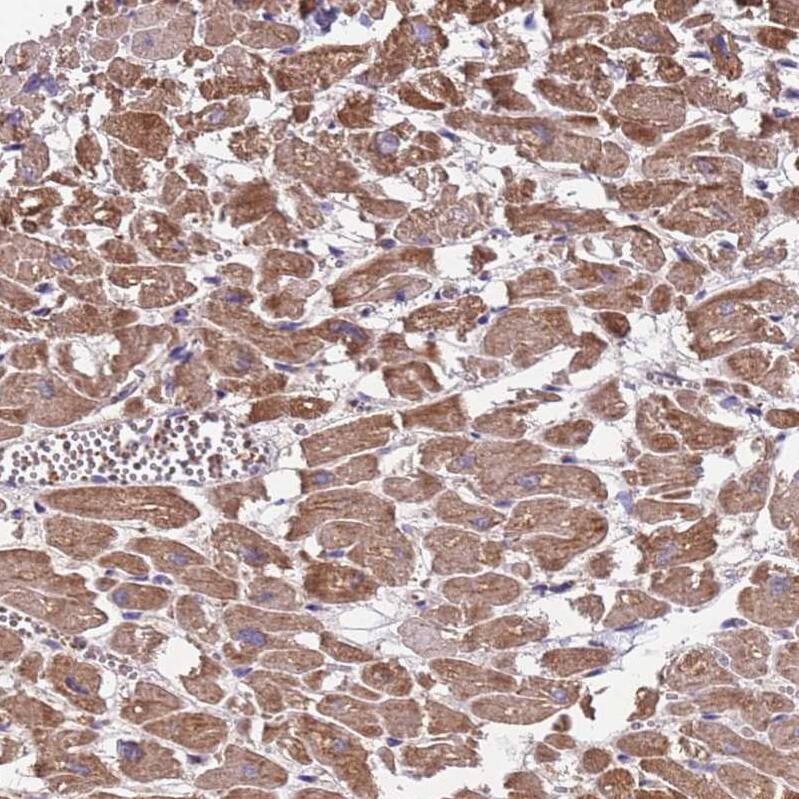 TMEM126A Antibody - BSA Free Immunohistochemistry: TMEM126A Antibody - BSA Free [NBP2-13444]