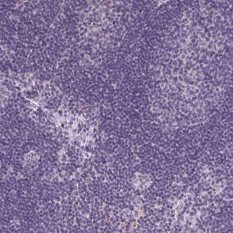 Collectrin/TMEM27 Antibody - BSA Free Immunohistochemistry: Collectrin/TMEM27 Antibody - BSA Free [NBP2-13450]