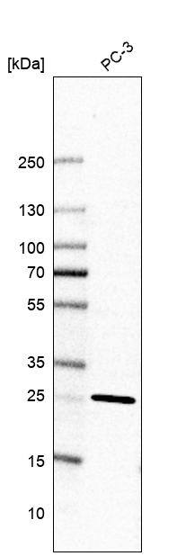 TMEM55B Antibody - BSA Free Western Blot: TMEM55B Antibody - BSA Free [NBP2-13453]