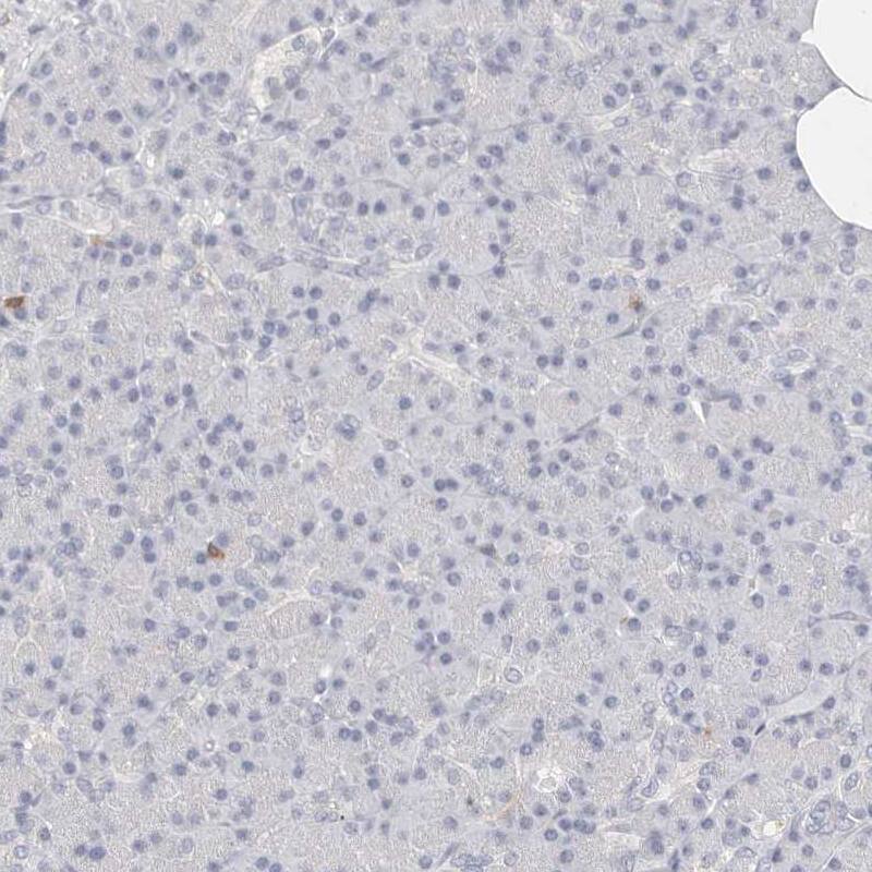TMEM63B Antibody - BSA Free Immunohistochemistry: TMEM63B Antibody - BSA Free [NBP2-13455]
