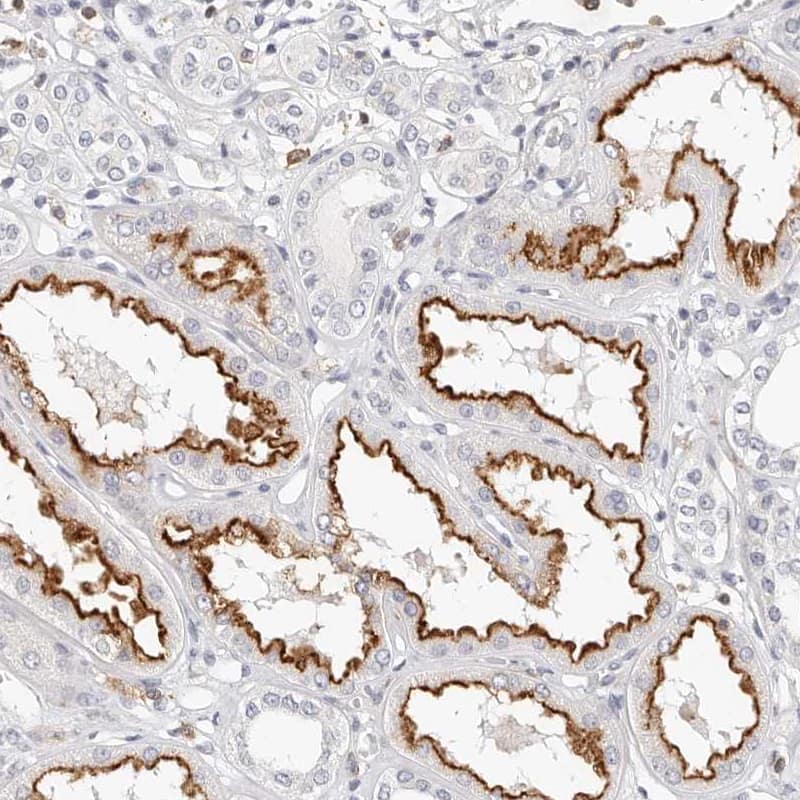 TMEM63B Antibody - BSA Free Immunohistochemistry: TMEM63B Antibody - BSA Free [NBP2-13455]