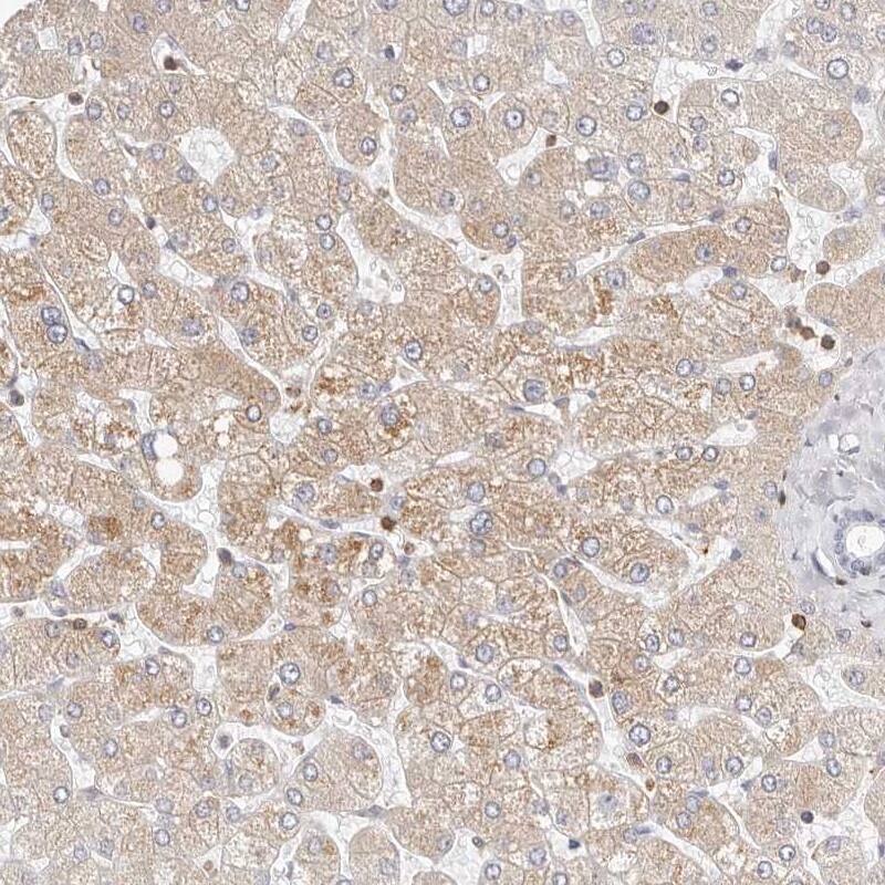 TMEM63B Antibody - BSA Free Immunohistochemistry: TMEM63B Antibody - BSA Free [NBP2-13455]