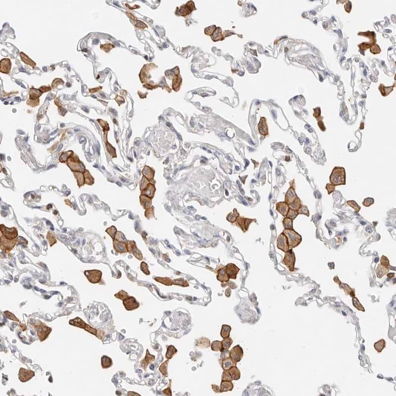 TMEM63B Antibody - BSA Free Immunohistochemistry: TMEM63B Antibody - BSA Free [NBP2-13455]