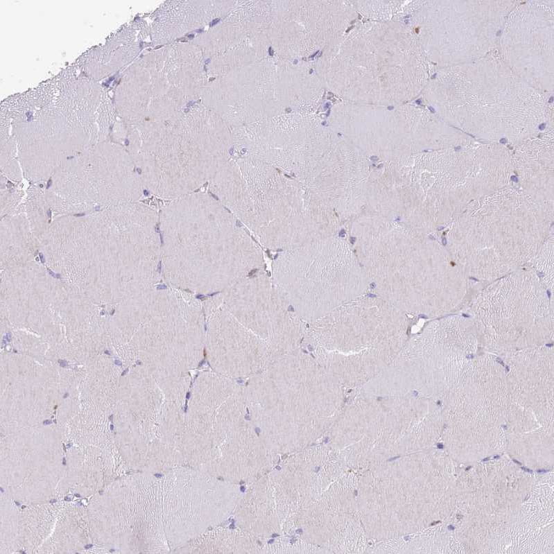 TOX2 Antibody - BSA Free Immunohistochemistry: TOX2 Antibody - BSA Free [NBP2-13464]