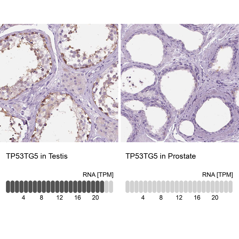 TP53TG5 Antibody - BSA Free Immunohistochemistry: TP53TG5 Antibody - BSA Free [NBP2-13467]