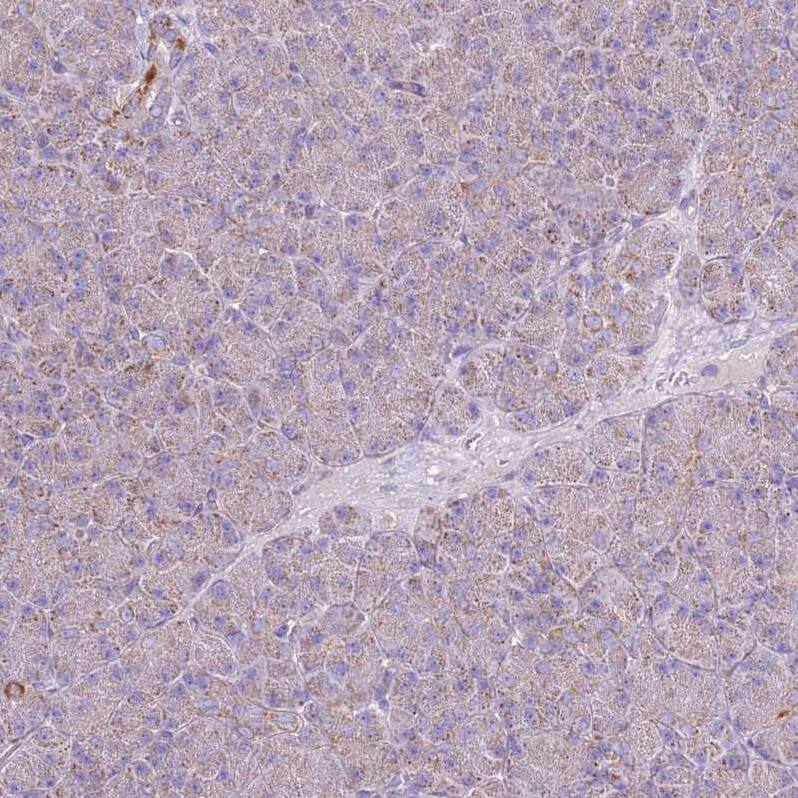 TRAPPC4 Antibody - BSA Free Immunohistochemistry: TRAPPC4 Antibody - BSA Free [NBP2-13476]