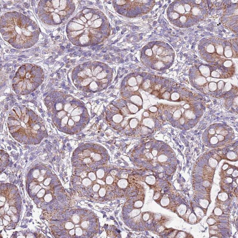 TRAPPC4 Antibody - BSA Free Immunohistochemistry: TRAPPC4 Antibody - BSA Free [NBP2-13476]