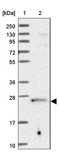 TRAPPC4 Antibody - BSA Free Western Blot: TRAPPC4 Antibody - BSA Free [NBP2-13476]