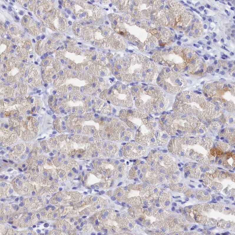 TRIM10 Antibody - BSA Free Immunohistochemistry: TRIM10 Antibody - BSA Free [NBP2-13479]