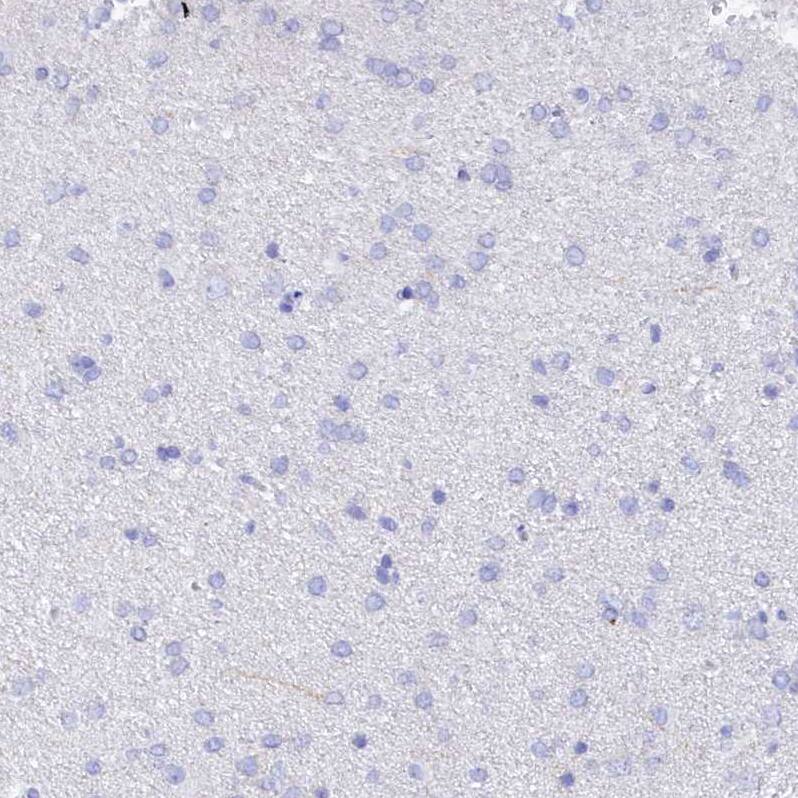 TRIM10 Antibody - BSA Free Immunohistochemistry: TRIM10 Antibody - BSA Free [NBP2-13479]